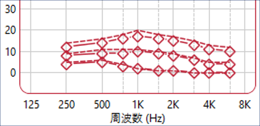 リサウンド