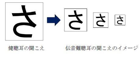 難聴について